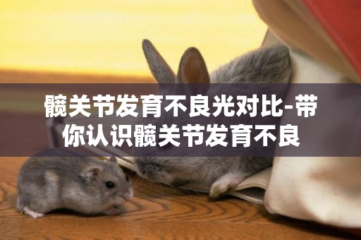 髖關節發育不良光對比-帶你認識髖關節發育不良