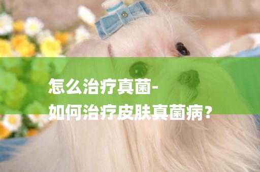 怎么治療真菌-
如何治療皮膚真菌病？