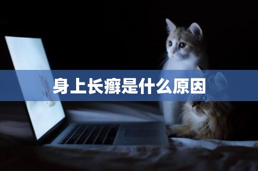 身上長癬是什么原因