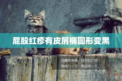屁股紅疹有皮屑橢圓形變黑