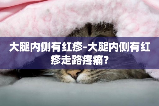 大腿內側有紅疹-大腿內側有紅疹走路疼痛？