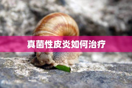 真菌性皮炎如何治療