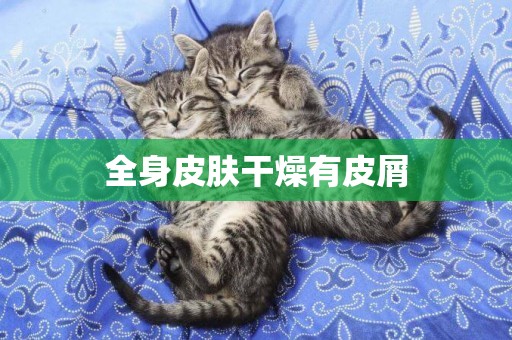 全身皮膚干燥有皮屑