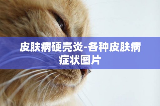 皮膚病硬殼炎-各種皮膚病癥狀圖片
