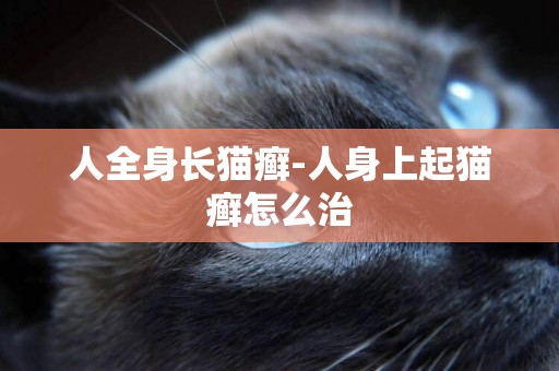 人全身長貓癬-人身上起貓癬怎么治