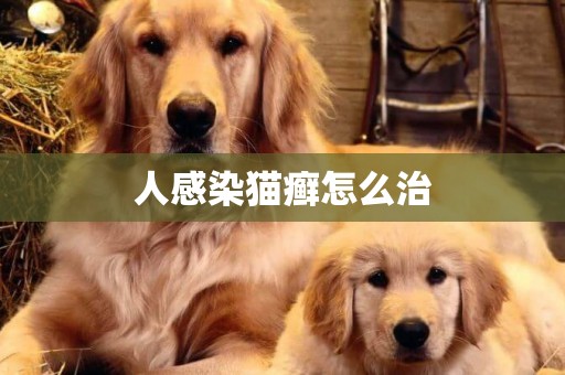 人感染貓癬怎么治