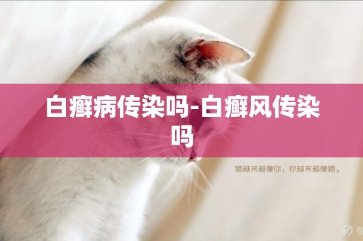 白癬病傳染嗎-白癬風傳染嗎