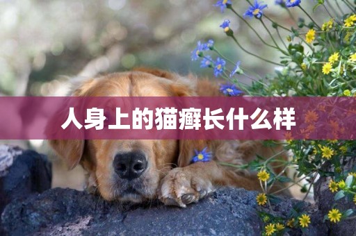 人身上的貓癬長什么樣