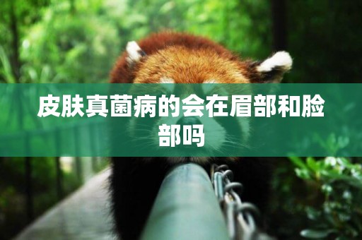 皮膚真菌病的會在眉部和臉部嗎
