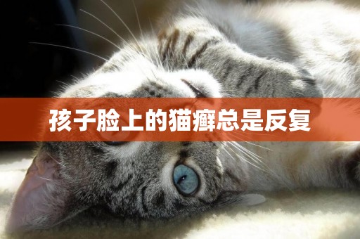 孩子臉上的貓癬總是反復