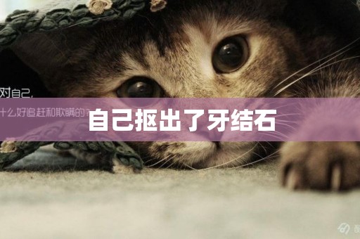 自己摳出了牙結石