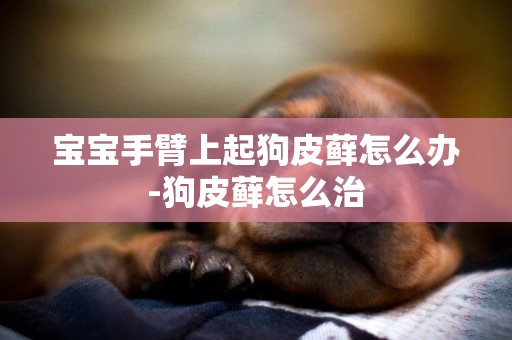 寶寶手臂上起狗皮蘚怎么辦-狗皮蘚怎么治