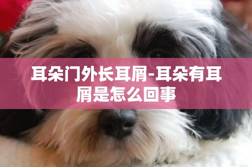 耳朵門外長耳屑-耳朵有耳屑是怎么回事