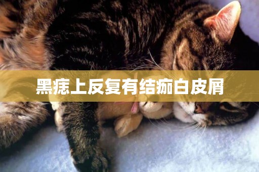 黑痣上反復有結痂白皮屑