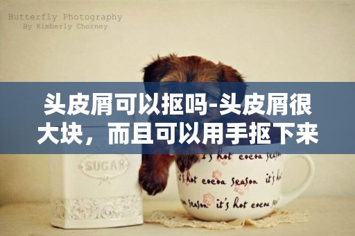 頭皮屑可以摳嗎-頭皮屑很大塊，而且可以用手摳下來