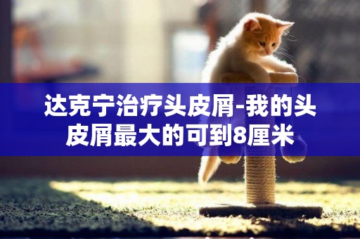 達克寧治療頭皮屑-我的頭皮屑最大的可到8厘米