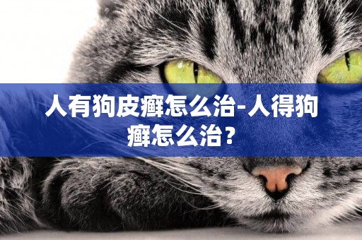 人有狗皮癬怎么治-人得狗癬怎么治？