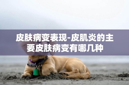 皮膚病變表現-皮肌炎的主要皮膚病變有哪幾種