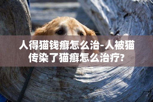 人得貓錢癬怎么治-人被貓傳染了貓癬怎么治療?