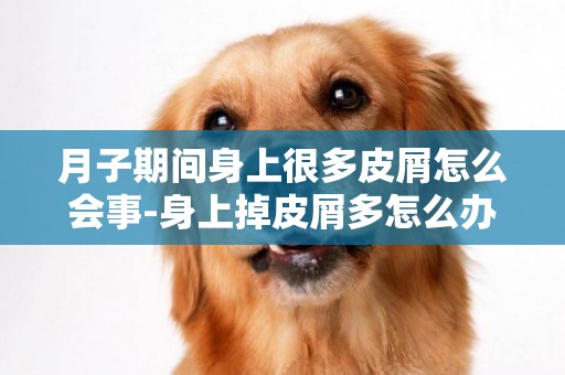 月子期間身上很多皮屑怎么會事-身上掉皮屑多怎么辦