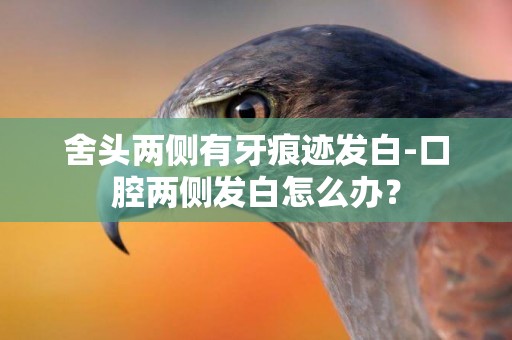 舍頭兩側有牙痕跡發白-口腔兩側發白怎么辦？