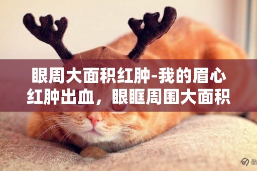 眼周大面積紅腫-我的眉心紅腫出血，眼眶周圍大面積浮腫是怎么回事啊？