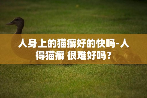 人身上的貓癬好的快嗎-人得貓癬 很難好嗎? 人身上的貓癬好的快嗎-人得貓癬 很難好嗎?