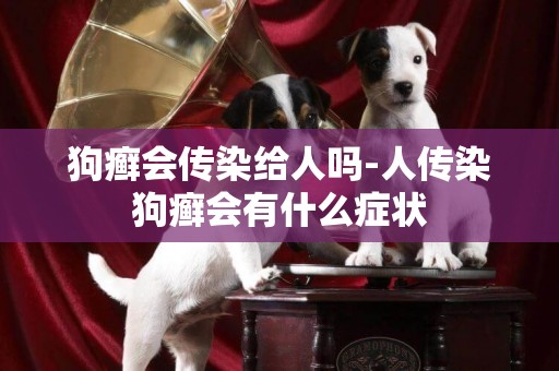 狗癬會傳染給人嗎-人傳染狗癬會有什么癥狀