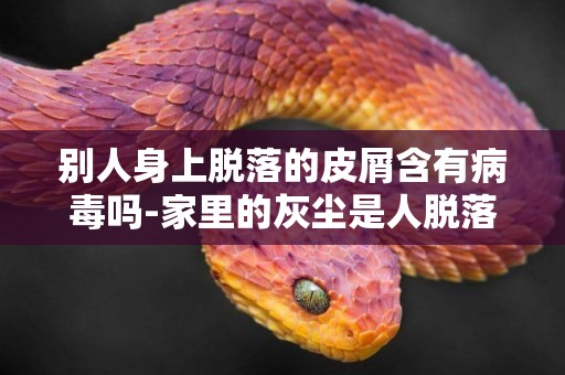 別人身上脫落的皮屑含有病毒嗎-家里的灰塵是人脫落的皮屑形成的嗎？
