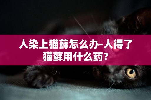 人染上貓蘚怎么辦-人得了貓蘚用什么藥？