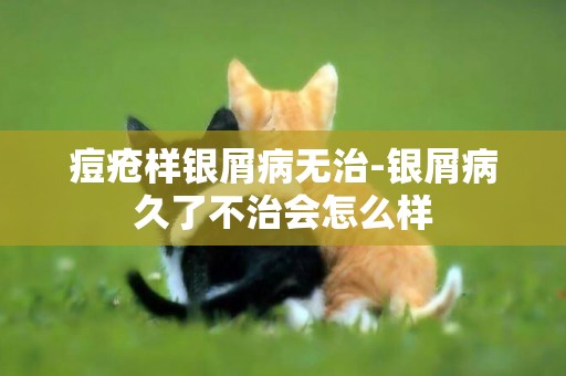 痘瘡樣銀屑病無治-銀屑病久了不治會怎么樣