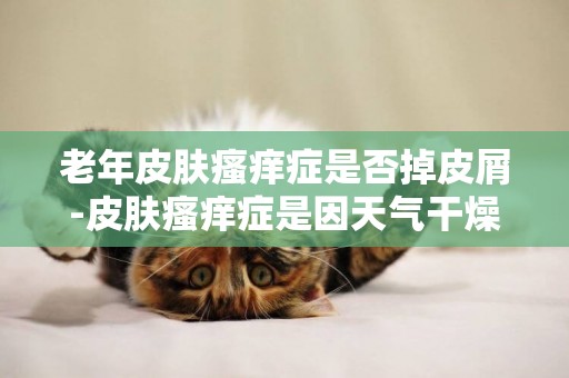 老年皮膚瘙癢癥是否掉皮屑-皮膚瘙癢癥是因天氣干燥嗎