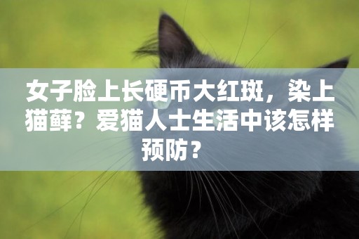 女子臉上長硬幣大紅斑，染上貓蘚？愛貓人士生活中該怎樣預防？ 