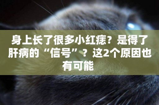 身上長了很多小紅痣？是得了肝病的“信號”？這2個原因也有可能 