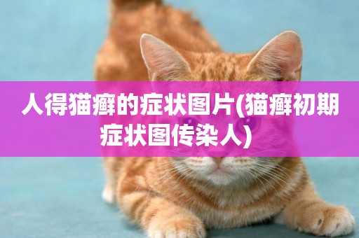 人得貓癬的癥狀圖片(貓癬初期癥狀圖傳染人) 