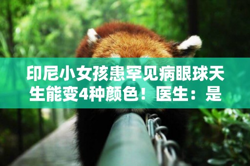 印尼小女孩患罕見病眼球天生能變4種顏色！醫生：是遺傳但無害 
