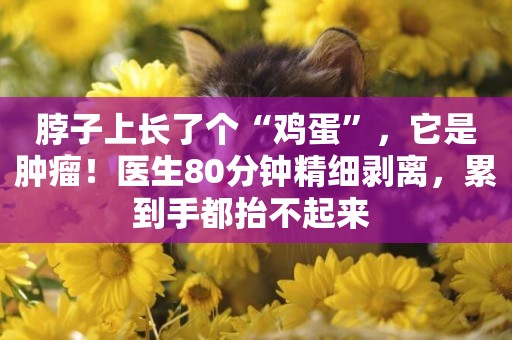脖子上長了個“雞蛋”，它是腫瘤！醫生80分鐘精細剝離，累到手都抬不起來 