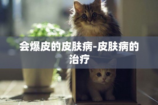 會爆皮的皮膚病-皮膚病的治療